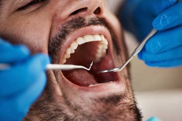 Best Teeth Whitening  in Utica, IN